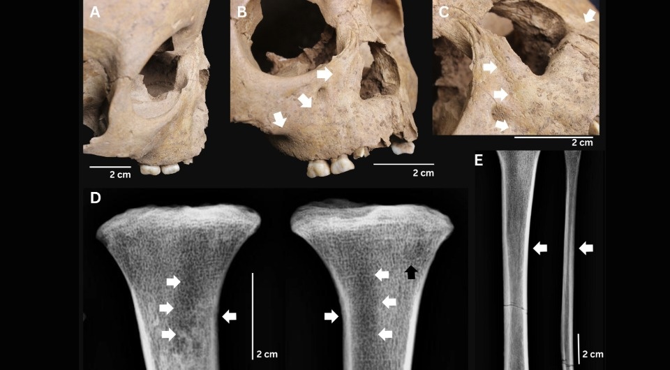   Melandri Vlok et al. / International Journal of Osteoarchaeology, 2026