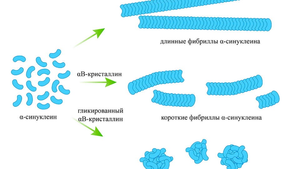 Избыток глюкозы может помочь защитить головной мозг от вредных белковых скоплений