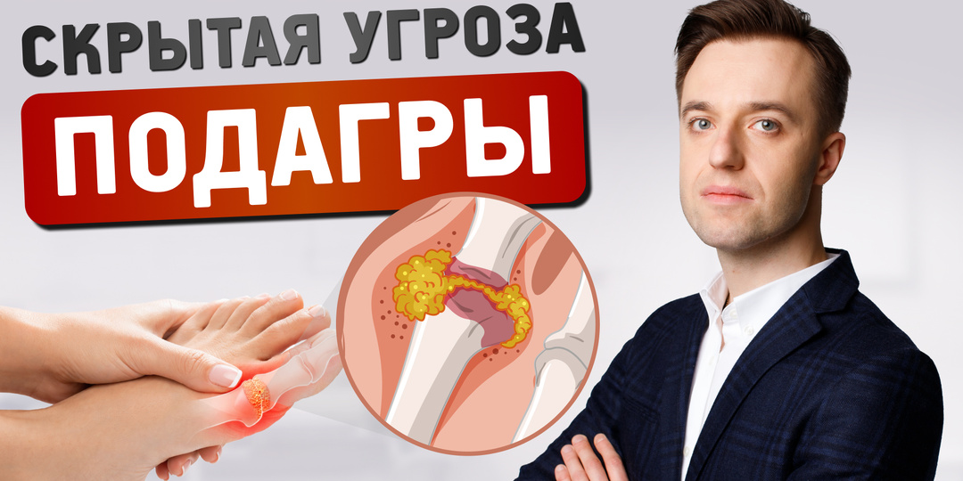 У меня просто повышена мочевая кислота, но суставы не болят. Зачем мне лечиться?