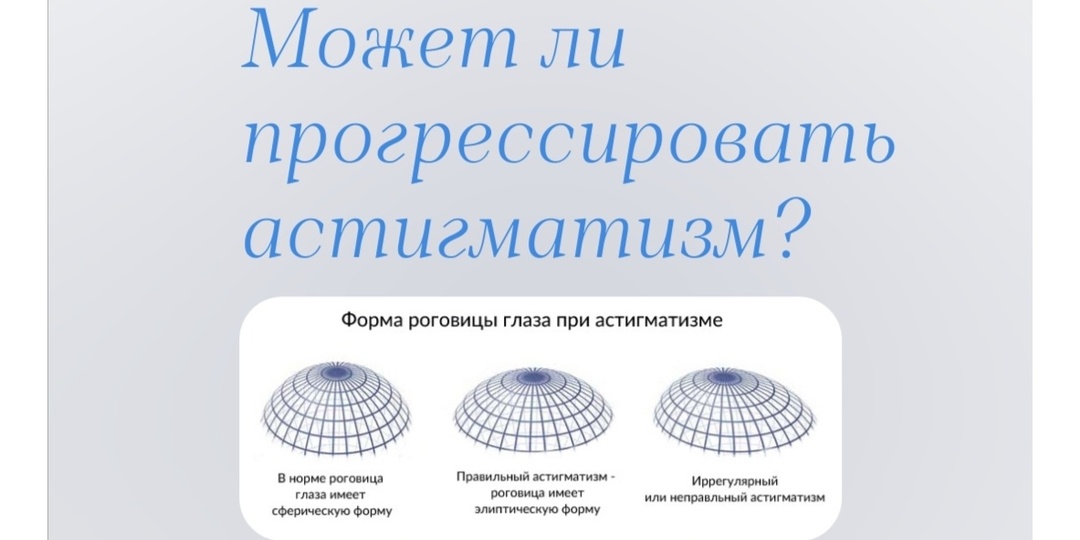 Может ли прогрессировать астигматизм?