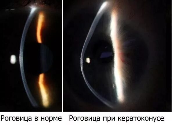 Рисунок взят из открытых источников. Спасибо автору.