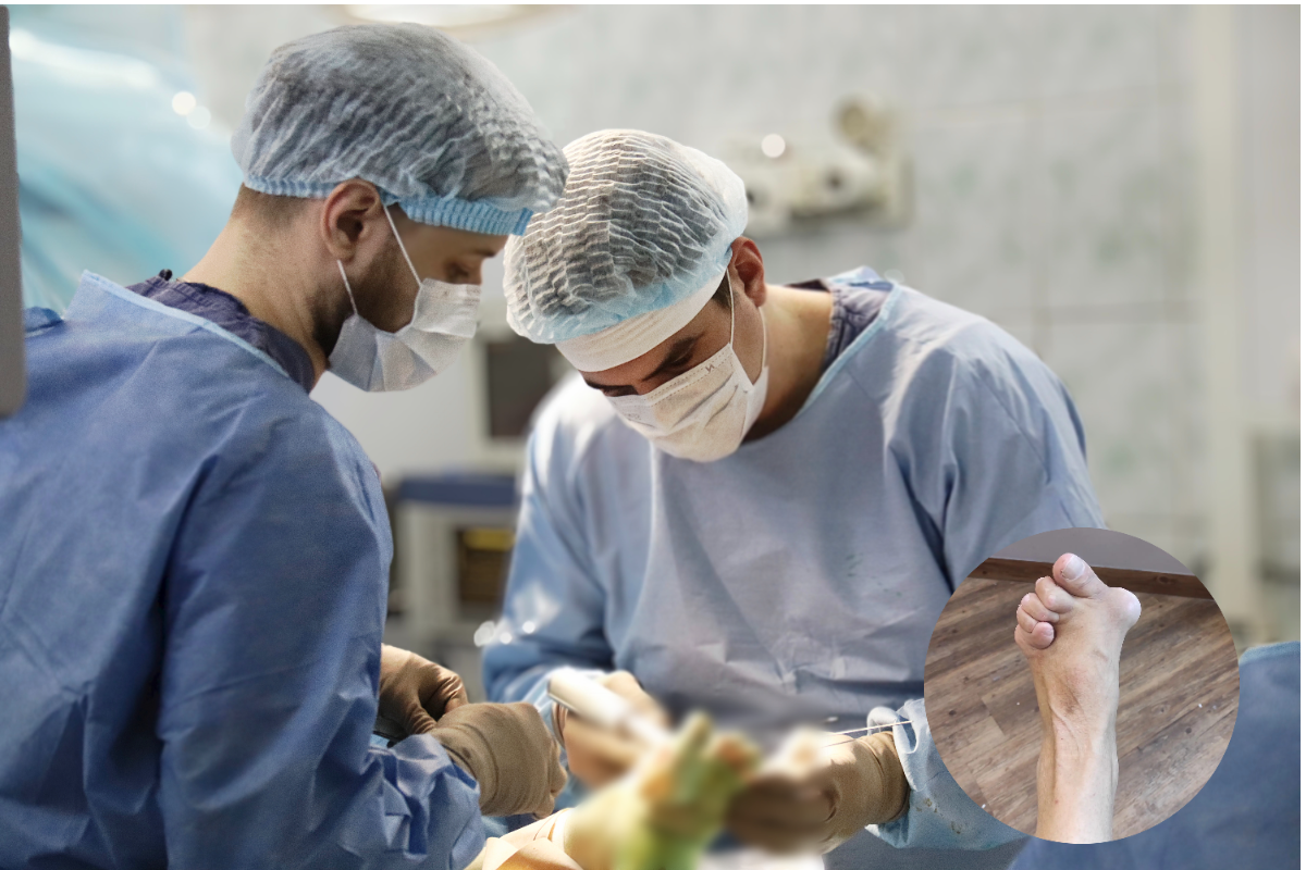 Тяжелая деформация возникла на фоне ревматоидного артрита