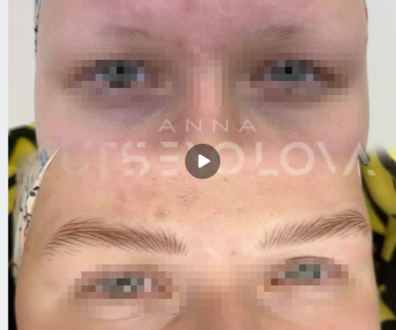 до-после. Из группы VK, к сожалению, точное название группы потеряла