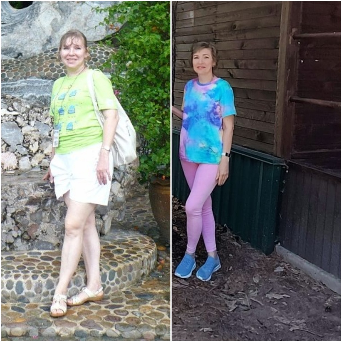 «До» и «После». Разница в 10 лет.