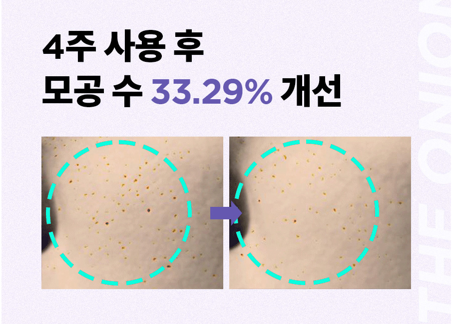 Уменьшение количества видимых пор на 33% за 4 недели. Скрин с оф. сайта https://isntree.com/