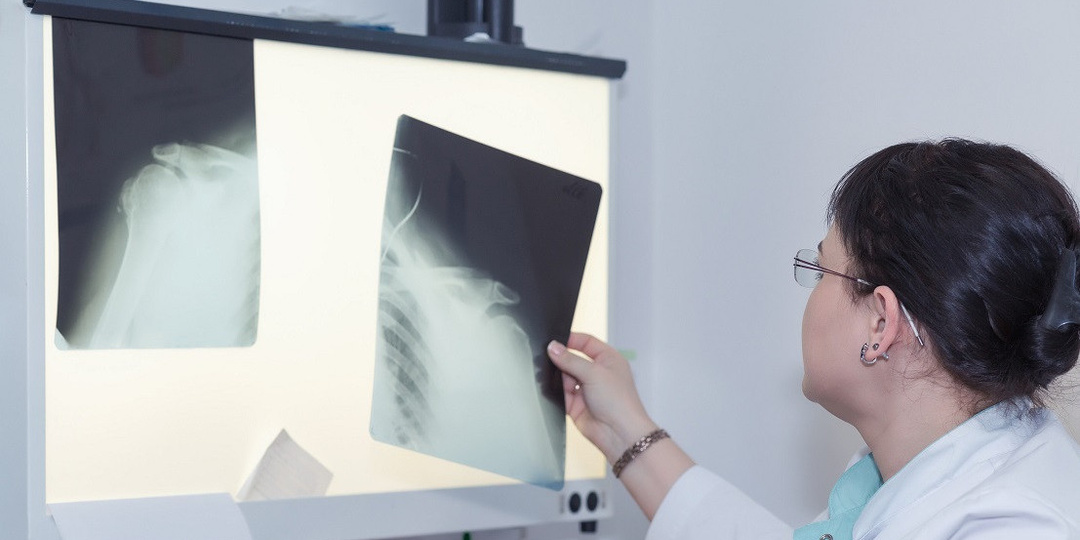 В России сообщили об историческом минимуме заболеваемости туберкулезом