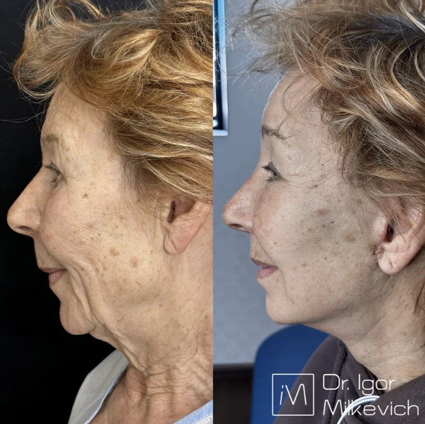 3 недели после операции.