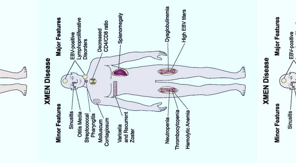   N + 1; Michael Lenardo / Wikimedia Commons / Public Domain