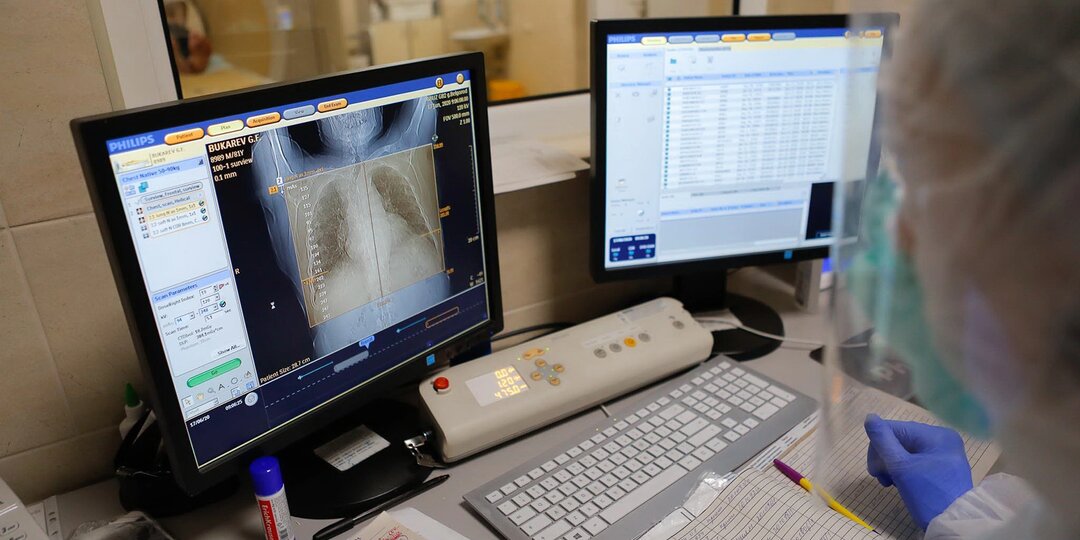 Почти у каждого четвёртого. Как не пропустить туберкулёз?