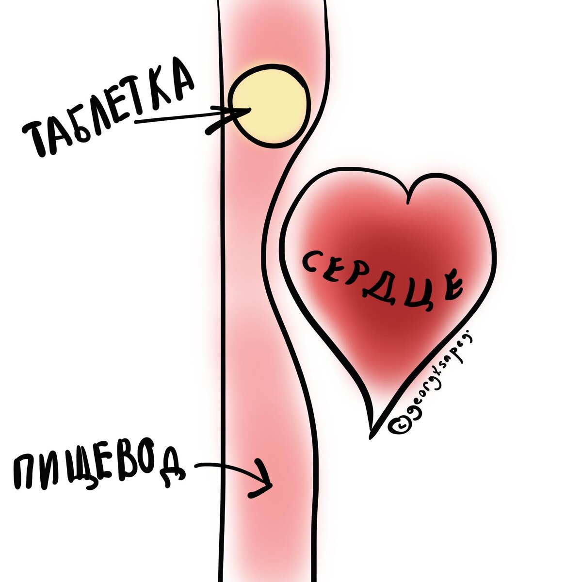Таблетка застряла