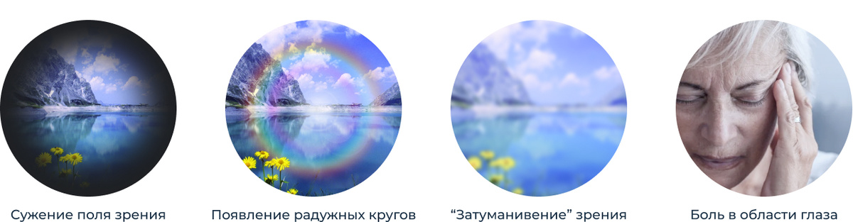 Возможные симптомы глаукомы