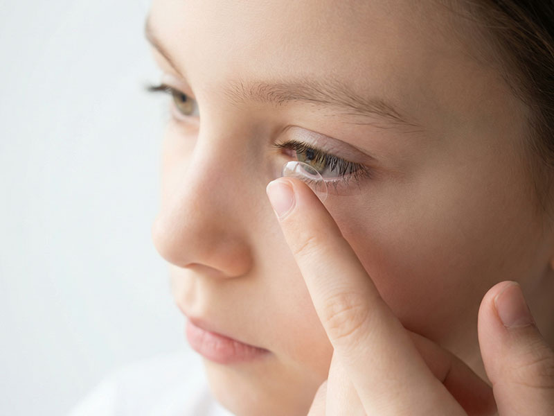 Ночные (ортокератологические) линзы позволяют обходиться без очков и контактных линз в течение дня.