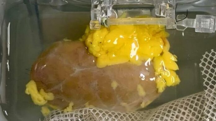    Революционные технологии USB-C для трансплантации органов: почки как универсальные компоненты, меняющие черный рынок и биохакинг.