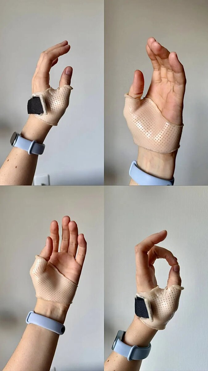 Ортезирование при ризартрозе
