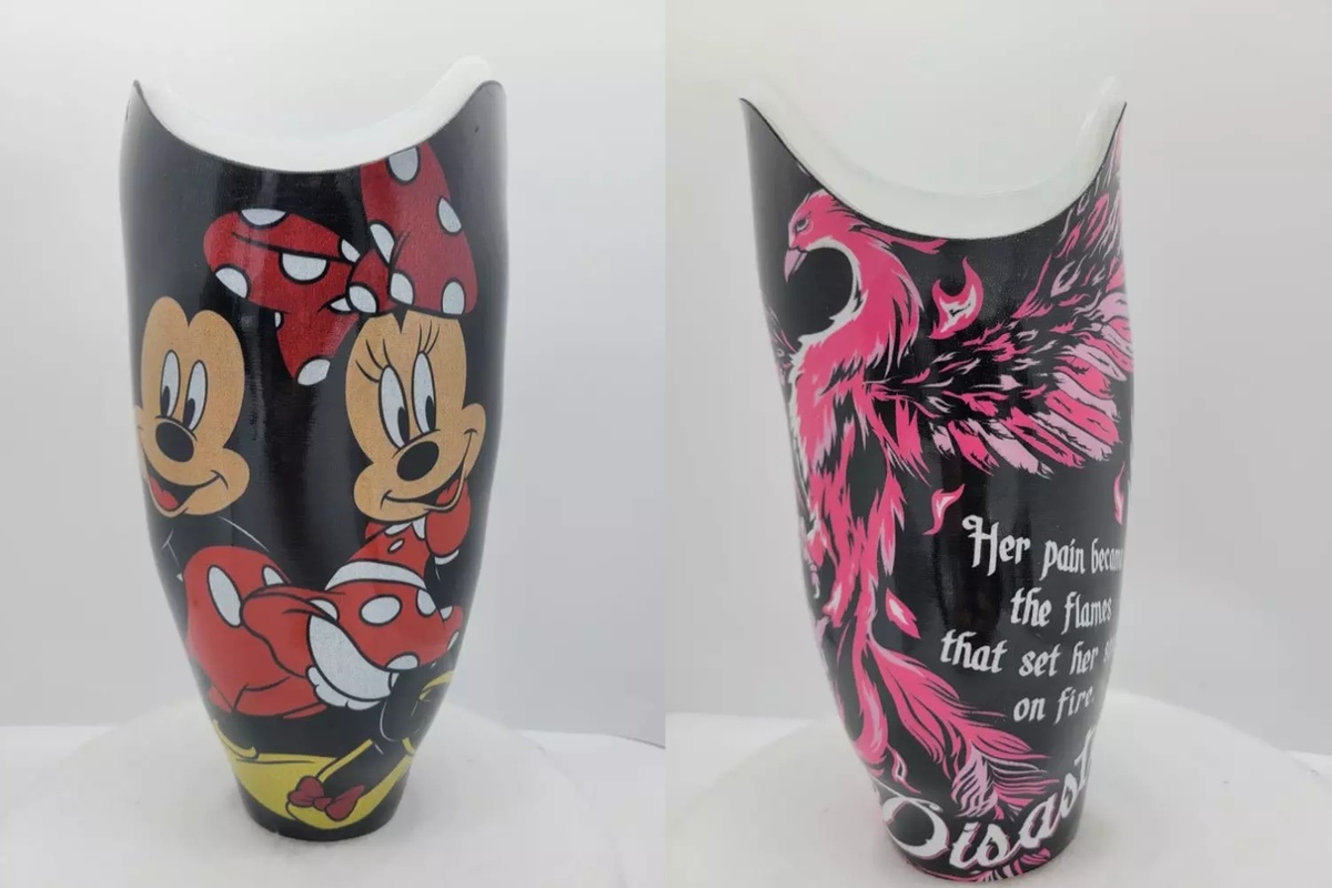 OPC📷Протезы ноги с персонализированным дизайном