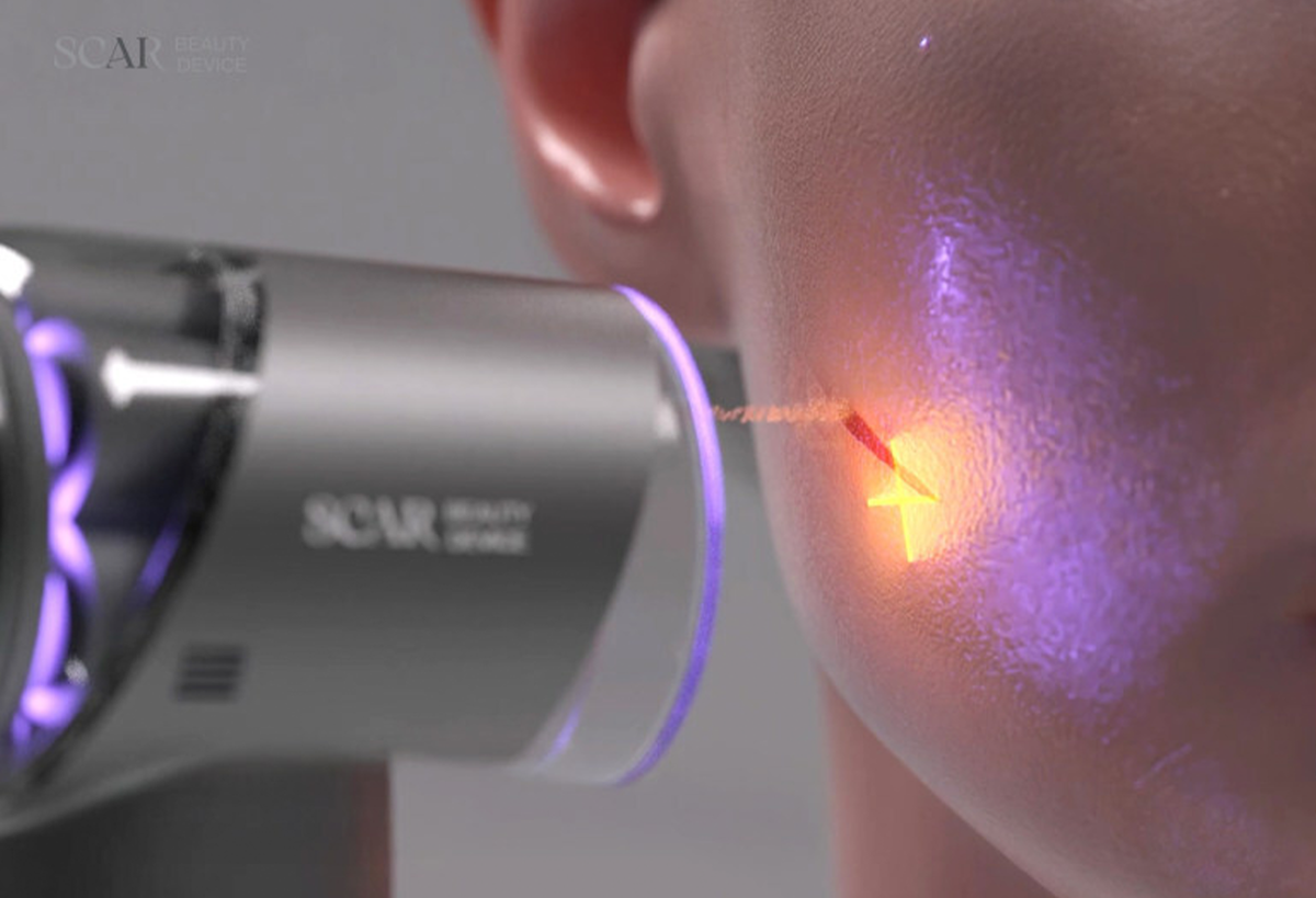 beautymatter.com📷Устройство для лечения рубцов