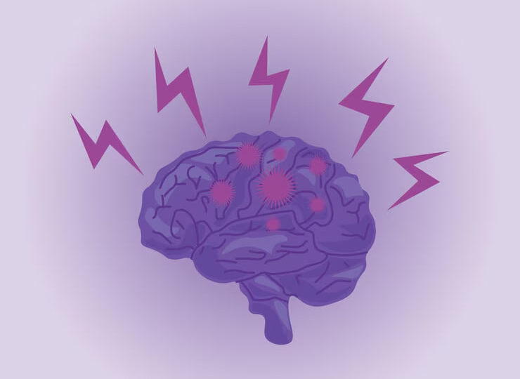 Что такое эпилептическая когнитивная дезинтеграция?