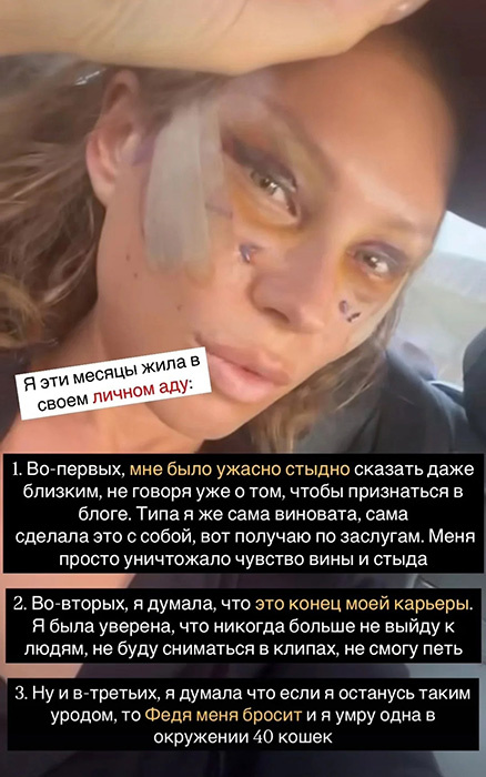    Рита Дакота показала результат в своих соцсетях.