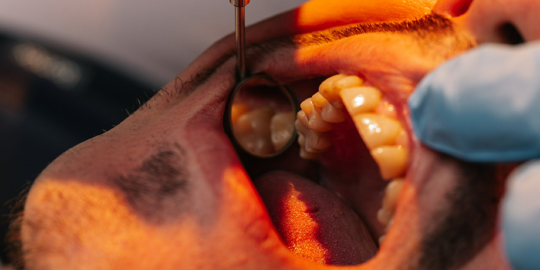 Удаление восьмерок: почему это сложная операция и кому ее можно доверить?