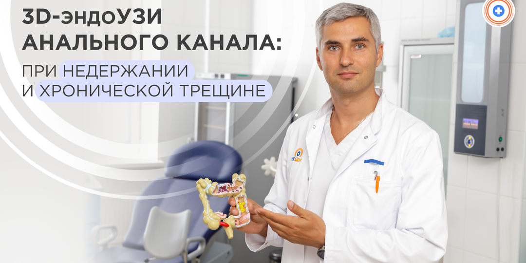 3D-эндоУЗИ анального канала: оценка сфинктеров при недержании и хронической трещине