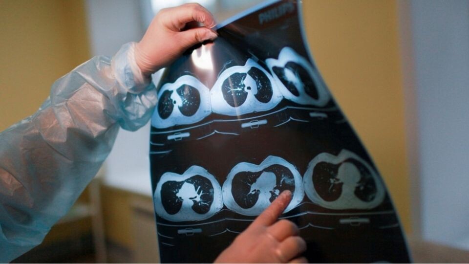    Компьютерный томограф. КТ. Источник: Сергей Кулыгин, "Бийский рабочий"