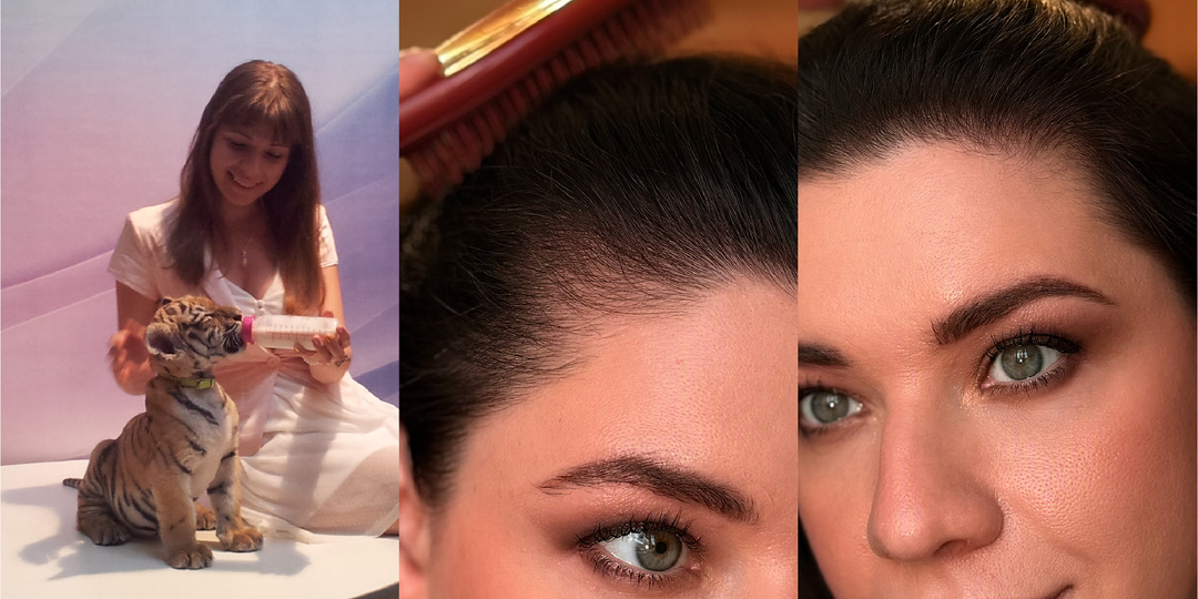 Разница между Андрогенной Алопецией и Диффузным выпадением волос