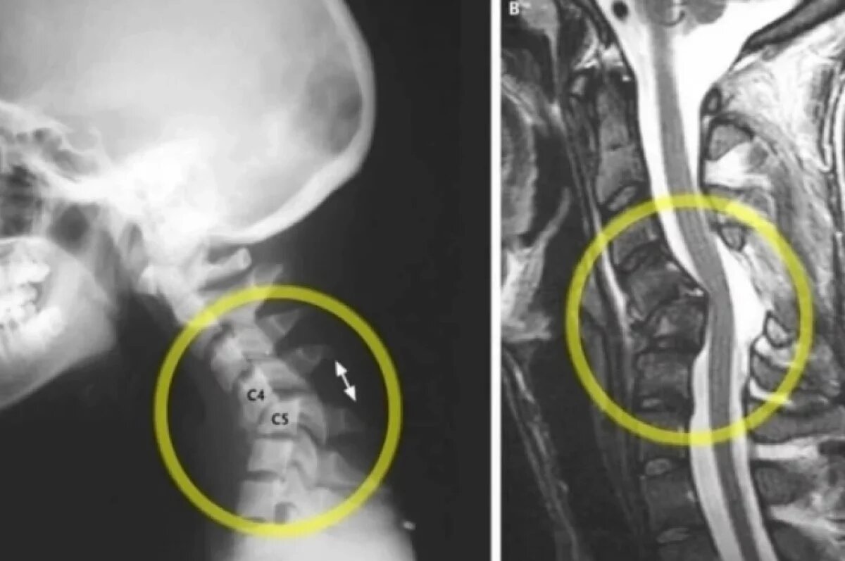    Первые в 2026 году смерти байкеров зафиксировали в Нижнем Новгороде