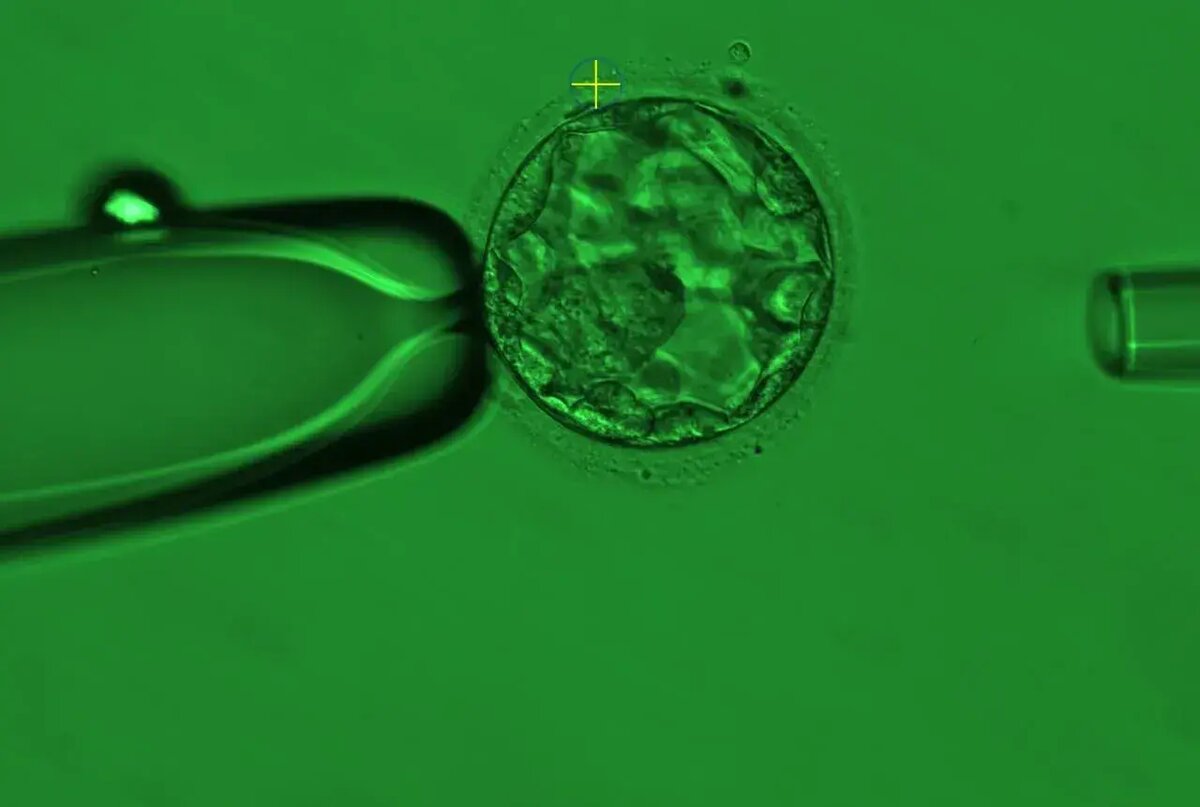 Эмбрион на стадии бластоцисты (5–6 сутки развития).