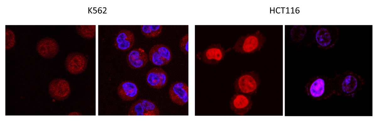 Свечение полученных соединений в ядрах раковых клеток (соединения светятся красным, ядро — синим). Источник: Александр Тихомиров / Научно-исследовательский институт по изысканию новых антибиотиков имени Г.Ф. Гаузе