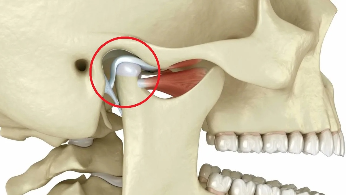 Суставной диск 