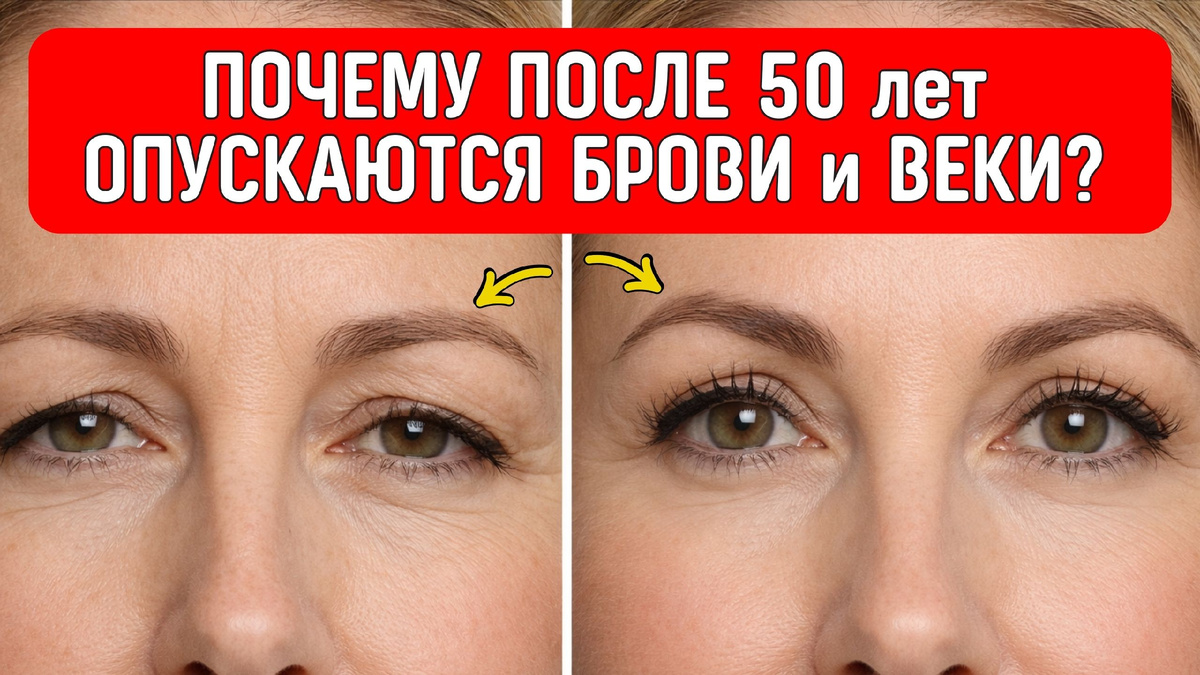 Провисшие брови и веки - это ещё не старость