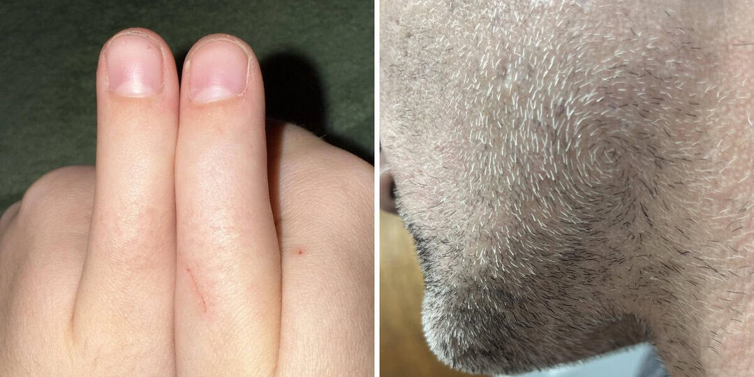 13 особенностей тела, которые люди внезапно обнаружили у себя (вы точно проверите свои руки)