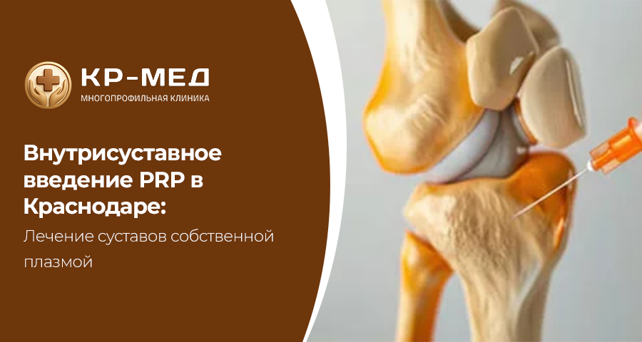 Боль в суставах и ограничение подвижности часто связаны с артрозом, воспалительными процессами и последствиями травм. Одним из современных методов лечения является внутрисуставное введение аутологичной плазмы, обогащённой тромбоцитами (PRP-терапия). В медицинском центре КР-Мед в Краснодаре процедура проводится с использованием собственного биоматериала пациента.

Суть метода PRP

Из крови пациента выделяется плазма, обогащённая тромбоцитами. После подготовки она вводится в полость поражённого сустава. Тромбоциты содержат факторы роста, которые способствуют восстановлению тканей и уменьшению воспаления.

Показания к PRP-терапии
•	артроз коленного и других суставов
•	хронические воспалительные процессы
•	спортивные травмы
•	болевой синдром при дегенеративных изменениях

Процедура проводится амбулаторно, занимает минимальное время и не требует длительной реабилитации.

Преимущества метода
•	использование собственного биоматериала
•	минимальный риск аллергических реакций
•	направленность на регенерацию тканей
•	уменьшение болевого синдрома

В медицинском центре КР-Мед в Краснодаре PRP-терапия применяется как часть комплексного лечения заболеваний опорно-двигательного аппарата.

Запись
Адрес клиники: г. Краснодар, ул.Калинина, 125
Запись в клинику: +7 (900) 244-88-85
