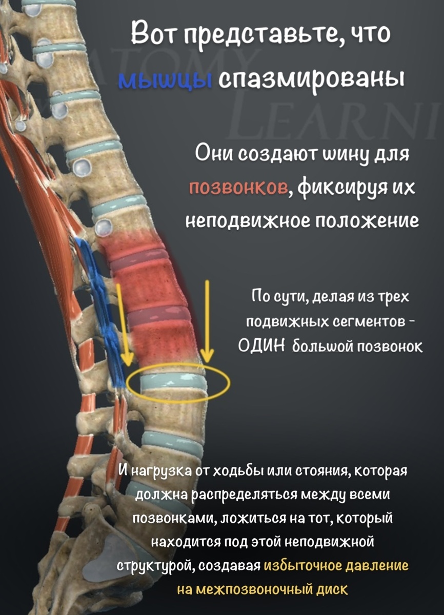 Мышечный спазм и позвоночник