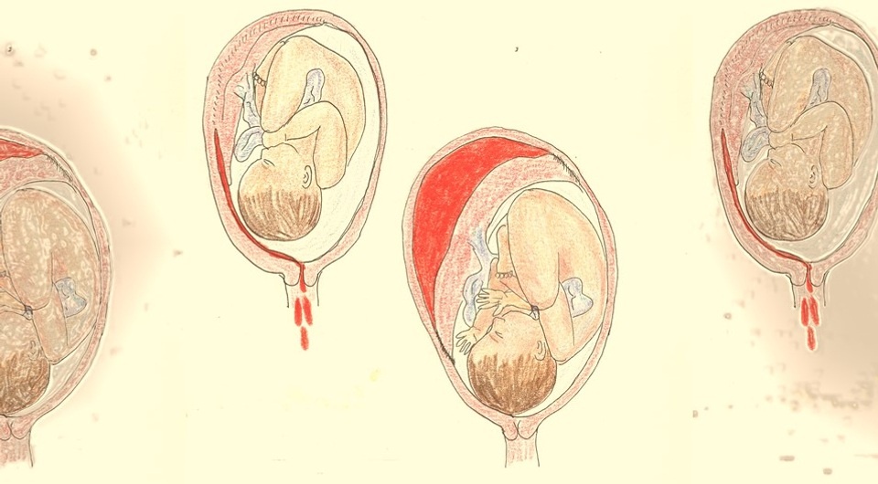   N + 1; Bonnie Urquhart Gruenberg / Wikimedia Commons / CC-BY-SA-4.0