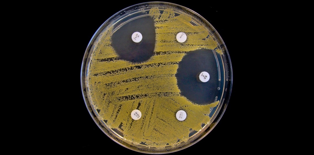 Фото https://scfh.ru/files/medialibrary/766/yh0p4frt0tzn99z7phd58zn5tcq75819.jpg