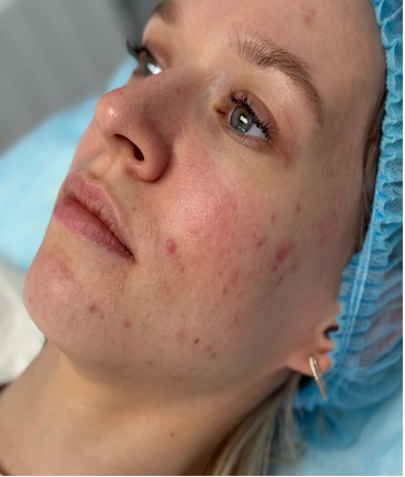 Пациент до начала лечения