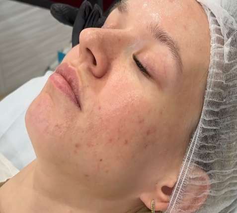 Промежуточный результат