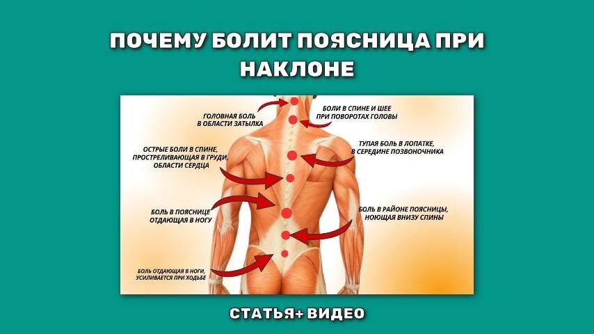 Болит спина при наклонах вниз. Причины.