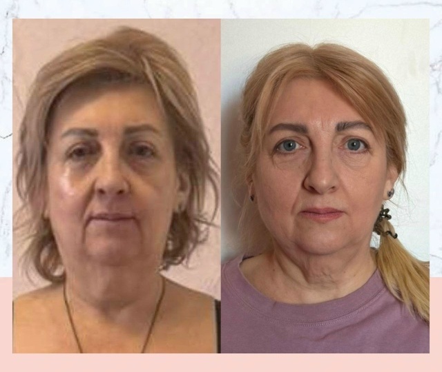 РЕЗУЛЬТАТ ОЛЬГИ👍