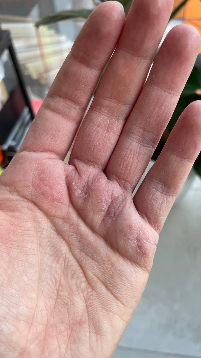 В подборке мои руки ДО использования средства