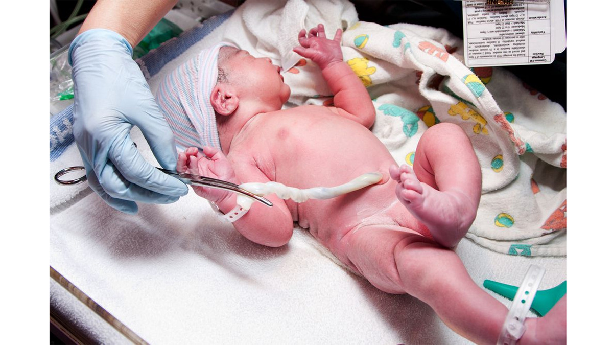 родовая травма