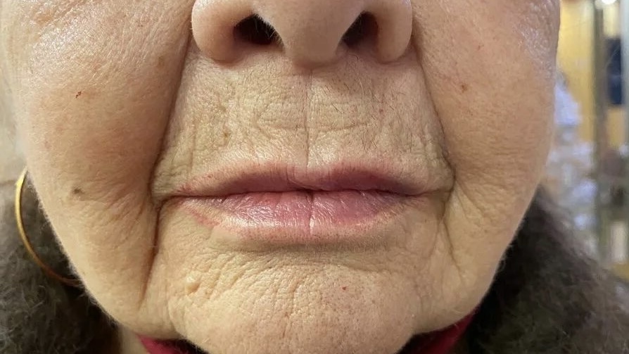 Инсулинорезистентность у каждого третьего: чек-лист для самопроверки после 50 лет