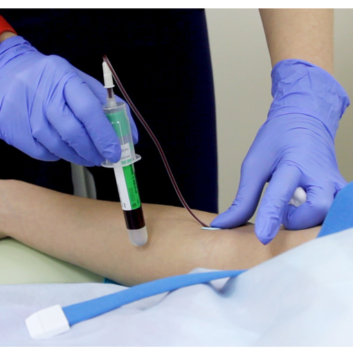 Процедура начинается с забора небольшого объёма крови в специальные сертифицированные пробирки, от качества которых зависит эффективность получаемой плазмы.