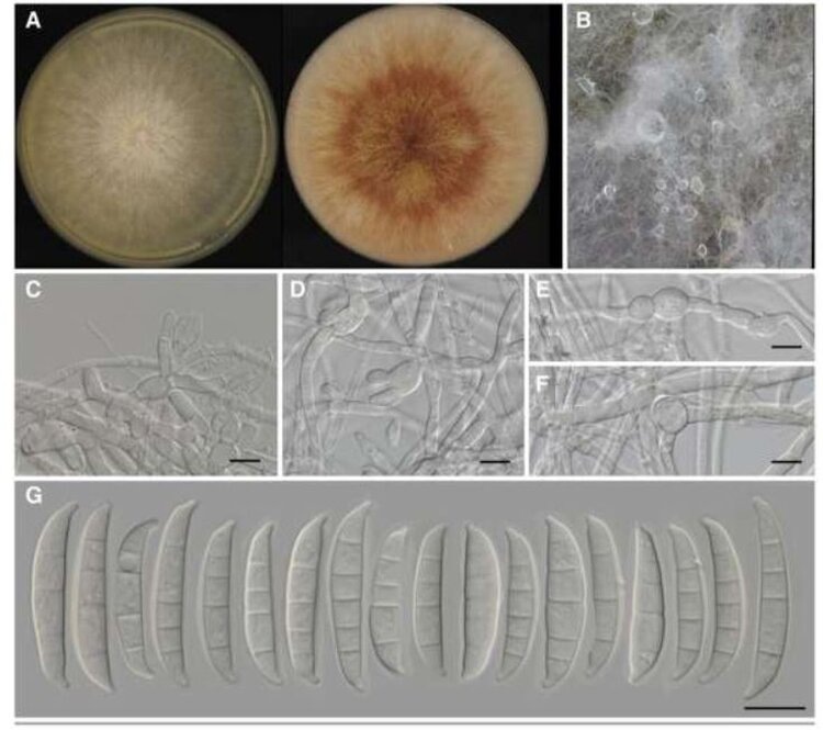 Макроскопические и микроскопические изображения Fusarium kistleri. A. Колонии на картофельно-декстрозном агаре (слева) и овсяном агаре (справа). B. Спородохии и скопления макроконидий. C и D. Конидиеносцы и конидиогенные клетки. E и F. Хламидоспоры. G. Макроконидии. Масштабные линейки для C-G составляют 10 мкм. Источник: Американское фитопатологическое общество. Лиза М. ДеГенринг и др.📷    Вспышку болезни пшеницы в Эфиопии вызвал новый вид грибов рода Fusarium
