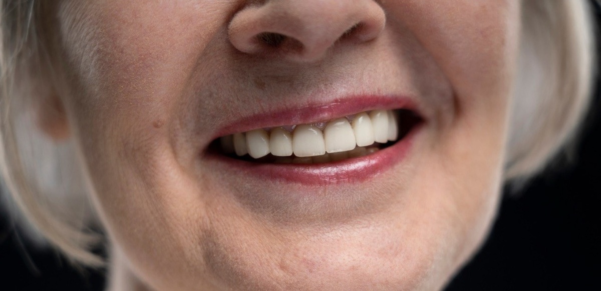 Протезирование зубов в Екатеринбурге