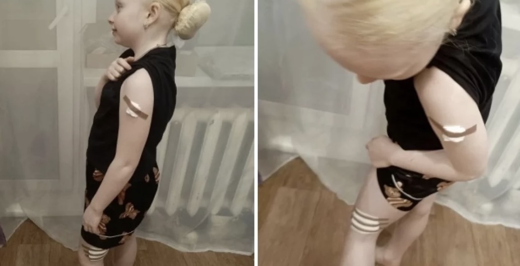 «Новый круг ада»: 10-летняя должница из Омска пережила нападение собаки