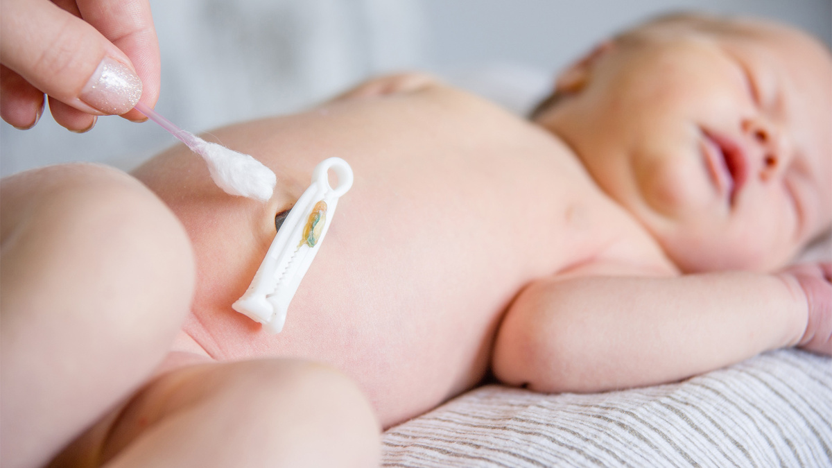 пупок новорождённого с прищепкой