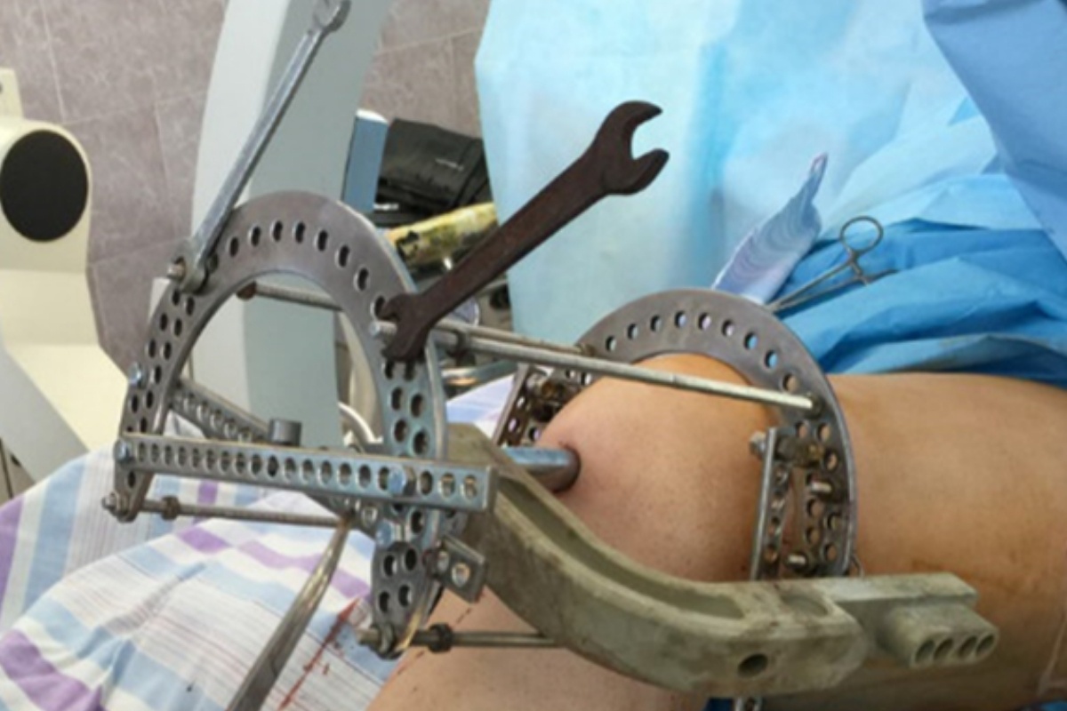    Фото: министерство здравоохранения Свердловской области