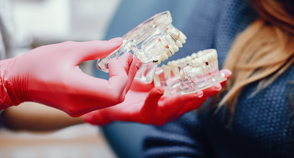 Короткие импланты: спасение или компромисс? Жесткая правда, которую ваш "стоматологический душнила" не договаривает